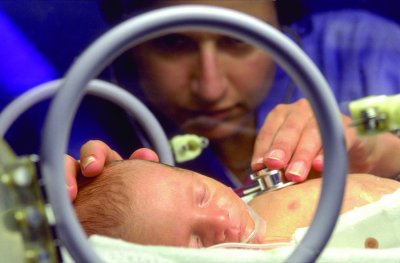 Premature Births and Cerebral Palsy