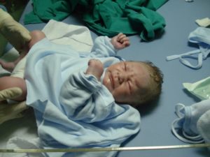 Cerebral Palsy Caused by Birth Injuries